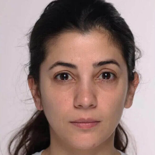 Woman with dark hair, after photo