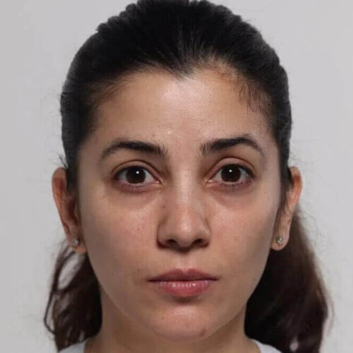 Woman with dark hair, before photo